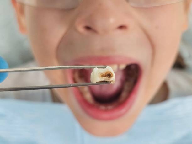 Best Emergency Dental Surgery in Collinsville, TX